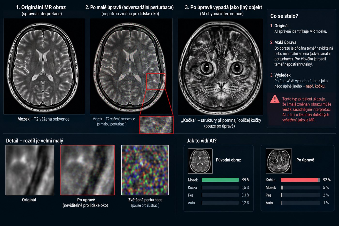 Ukázka, jak malá změna v obraze magnetické rezonance zcela změní závěr umělé inteligence